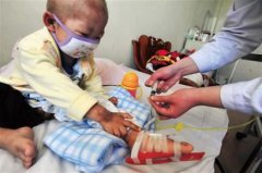 “白血病”兒童增加，甲醛危害值得關注