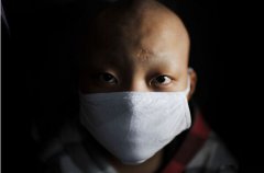 裝修除甲醛，預防白血病的其中一條途徑